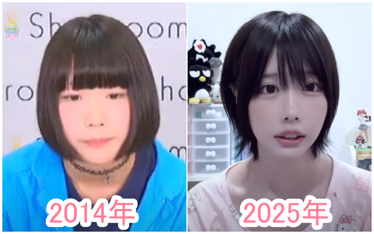 あのちゃん